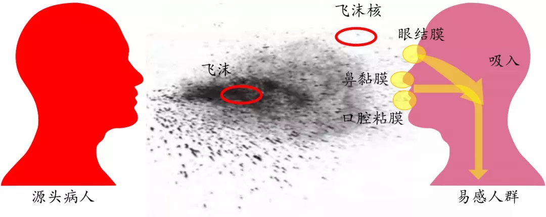 图2 直接传播